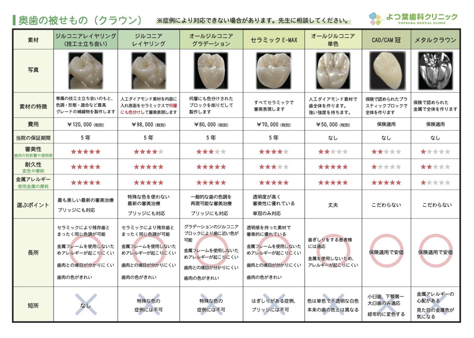 スマイルライン ポーセレンパレット smile line 歯科技工 - その他